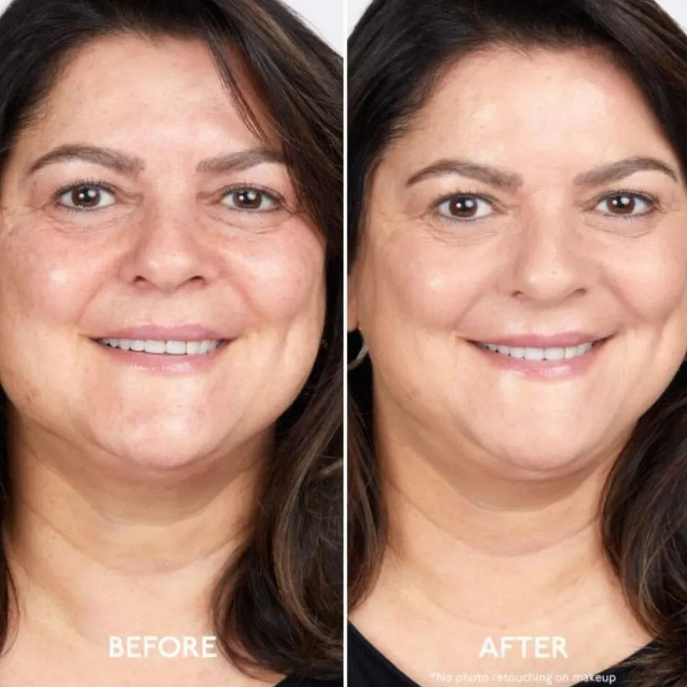 By Terry Ansikt|ByTerry Brightening CC Foundation