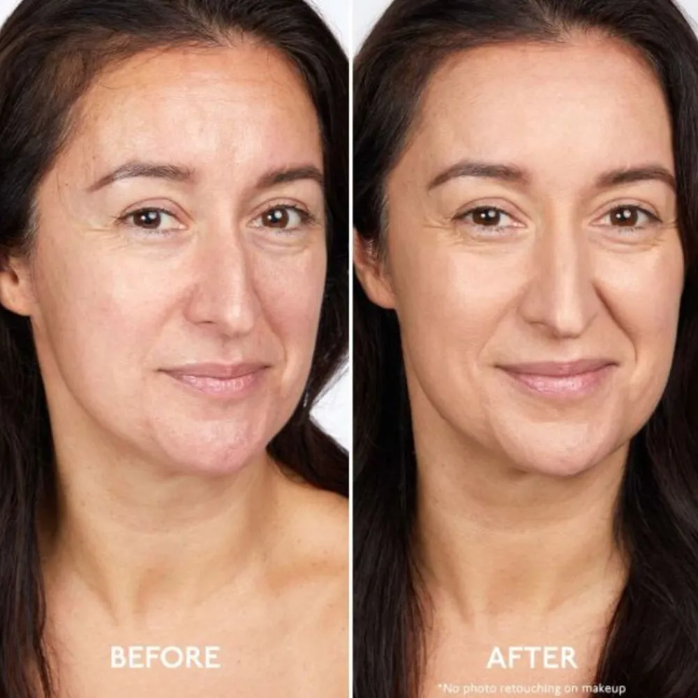 By Terry Ansikt|ByTerry Brightening CC Foundation