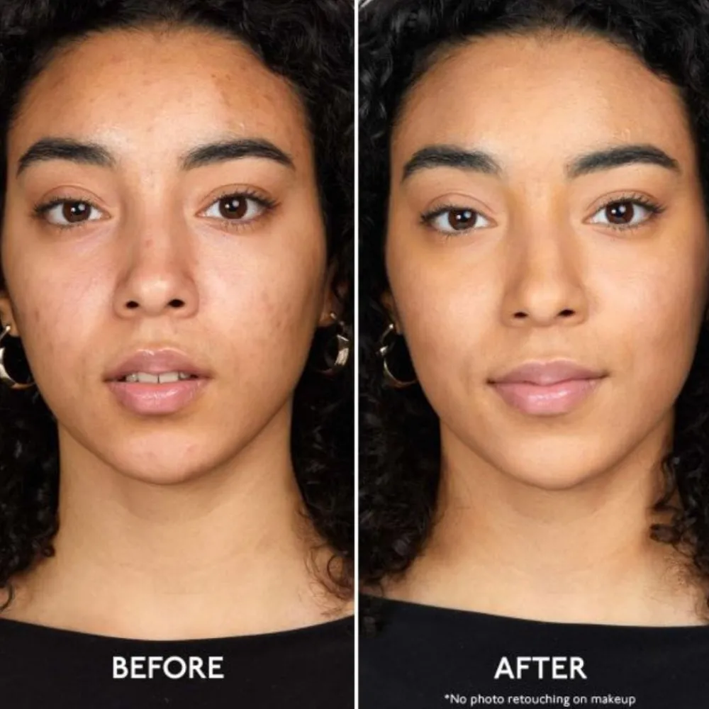 By Terry Ansikt|ByTerry Brightening CC Foundation