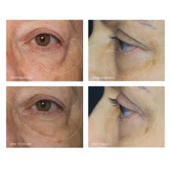 Dermalogica Øyepleie|Awaken Peptide Eye Gel