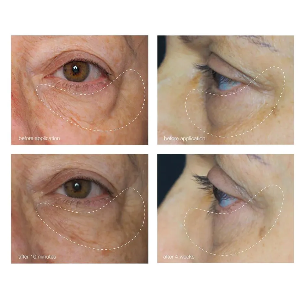 Dermalogica Øyepleie|Awaken Peptide Eye Gel