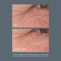 Dermalogica Ansiktskrem|Serum Og Ampuller|Dynamic Skin Retinol Serum