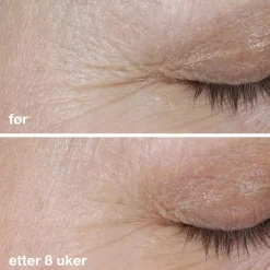 Dermalogica Serum Og Ampuller|Phyto Nature Firming Serum