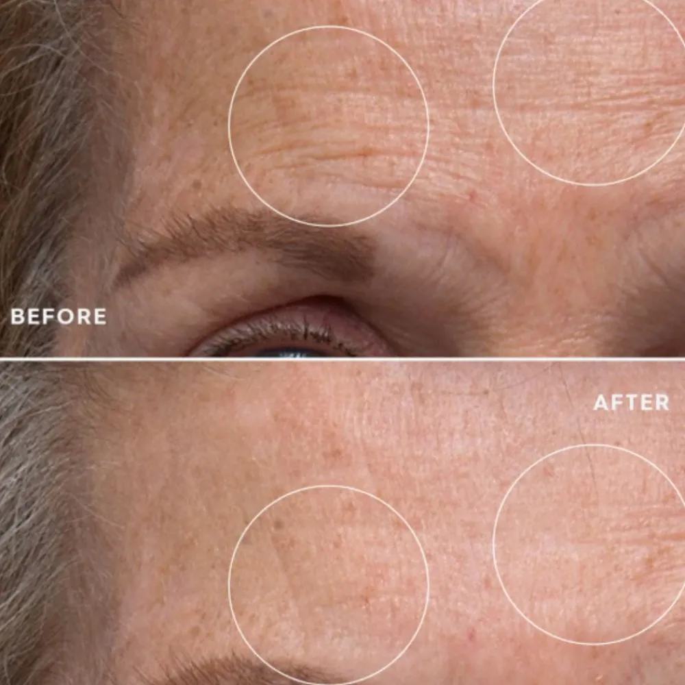 Elemis Serum Og Ampuller|Pro-Collagen Renewal Serum