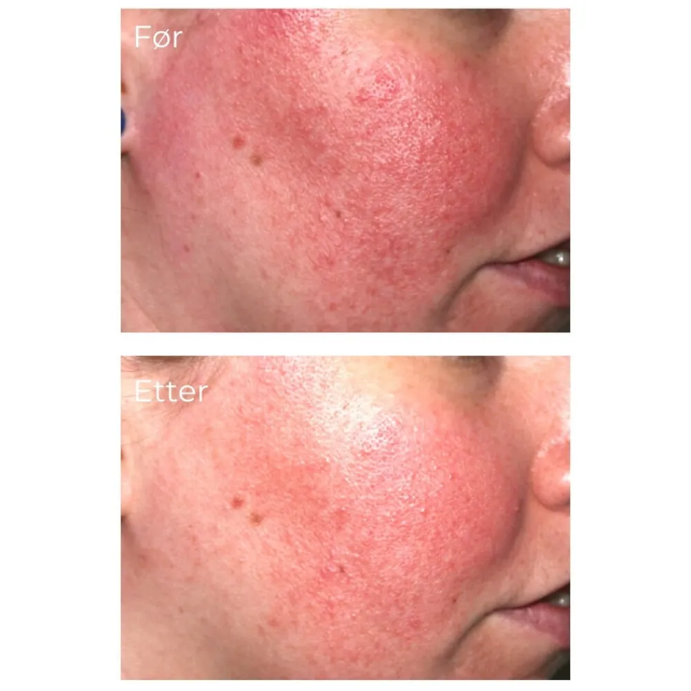 iS Clinical Serum Og Ampuller|Pro-Heal Serum Advance+ 30 ml