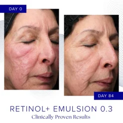 iS Clinical Ansiktskrem|Retinol+ Emulsion 0.3