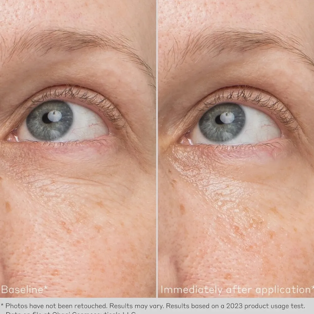 Obagi Medical Øyepleie|Obagi Daily Hydro-Drops Eye Gel Cream