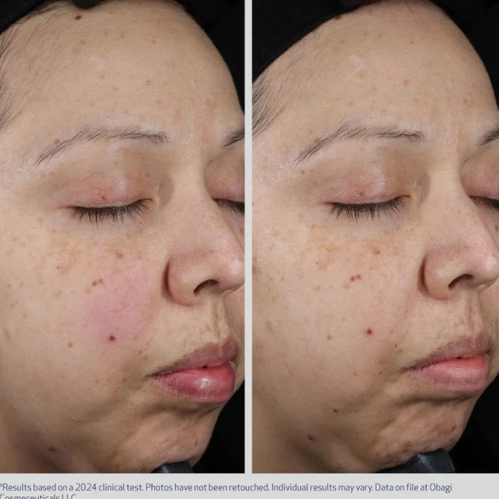 Obagi Medical Ansiktskrem|Obagi Moisture Restore