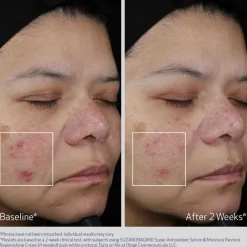 Obagi Medical Serum Og Ampuller|Obagi Super Antioxidant Serum