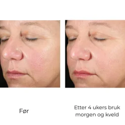 Skinbetter-Science Serum Og Ampuller|Skinbetter Alto Advanced Defense And Repair Serum 30 ML