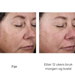 Skinbetter-Science Serum Og Ampuller|Skinbetter Alto Advanced Defense And Repair Serum 30 ML