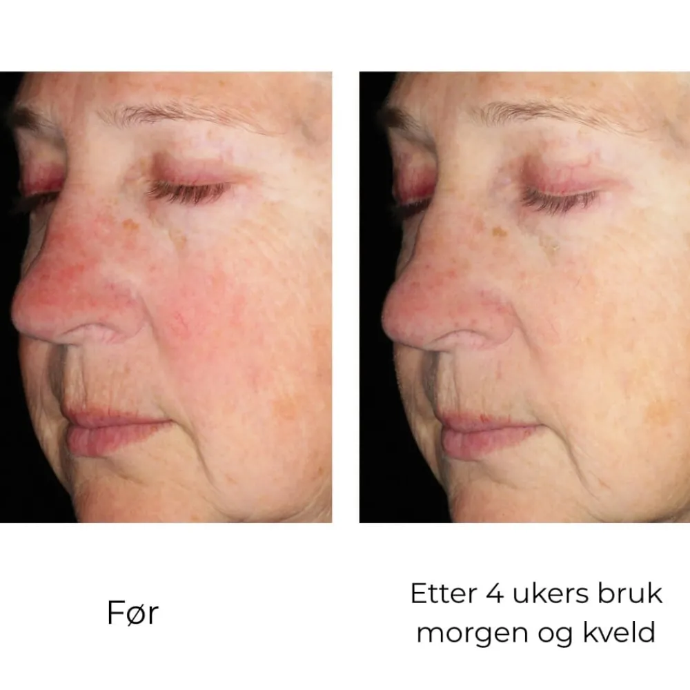 Skinbetter-Science Serum Og Ampuller|Skinbetter Alto Defense Serum Face