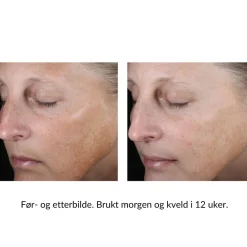 Skinbetter-Science Gravid Og Ammende|Serum Og Ampuller|Skinbetter Even Tone Correcting Serum
