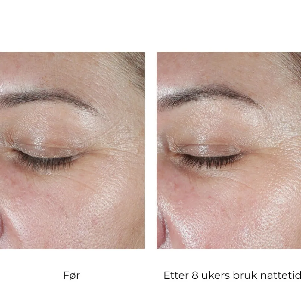 Skinbetter-Science Øyepleie|Skinbetter EyeMax AlphaRet Overnight Cream Eye