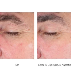 Skinbetter-Science Øyepleie|Skinbetter EyeMax AlphaRet Overnight Cream Eye