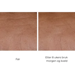 Skinbetter-Science Ansiktskrem|Skinbetter InterFuse Treatment Cream Face & Neck