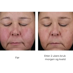 Skinbetter-Science Serum Og Ampuller|Skinbetter Mystro Active Balance Serum