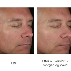 Skinbetter-Science Hudpleie|Ansiktskrem|Skinbetter Solo Hydrating Defense MEN