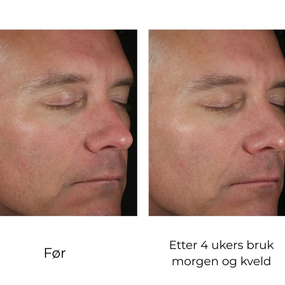 Skinbetter-Science Hudpleie|Ansiktskrem|Skinbetter Solo Hydrating Defense MEN