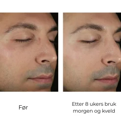 Skinbetter-Science Hudpleie|Ansiktskrem|Skinbetter Solo Hydrating Defense MEN