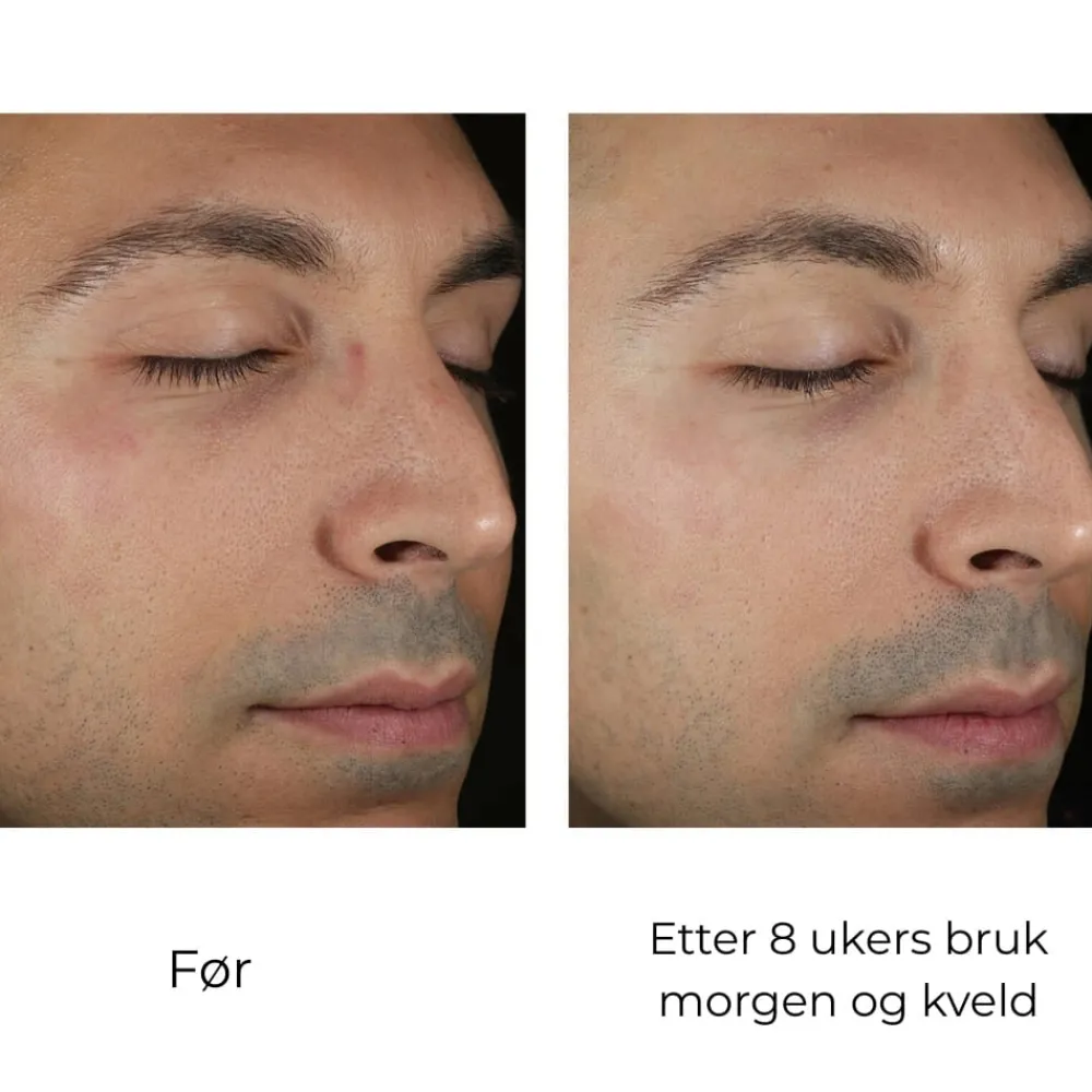 Skinbetter-Science Hudpleie|Ansiktskrem|Skinbetter Solo Hydrating Defense MEN