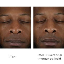 Skinbetter-Science Hudpleie|Ansiktskrem|Skinbetter Solo Hydrating Defense MEN