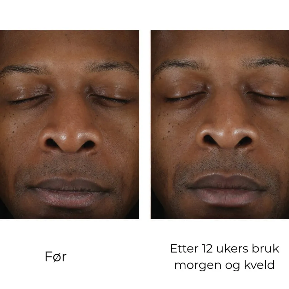 Skinbetter-Science Hudpleie|Ansiktskrem|Skinbetter Solo Hydrating Defense MEN