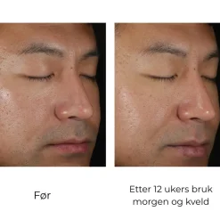 Skinbetter-Science Hudpleie|Ansiktskrem|Skinbetter Solo Hydrating Defense MEN