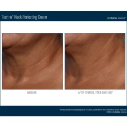 Skinbetter-Science Ansiktskrem|Hals Og Décolleté|Skinbetter Techno Neck Perfecting Cream