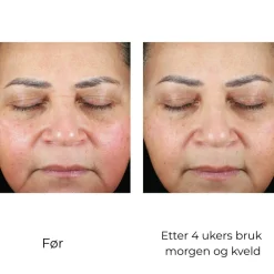 Skinbetter-Science Ansiktskrem|Skinbetter Trio Luxe Moisture Treatment