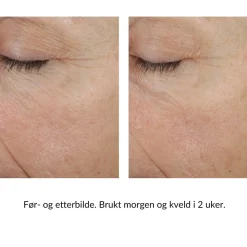 Skinbetter-Science Ansiktskrem|Skinbetter Trio Rebalancing Moisture Treatment